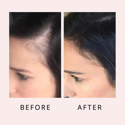 Scalpy Boost+ Hair Growth
